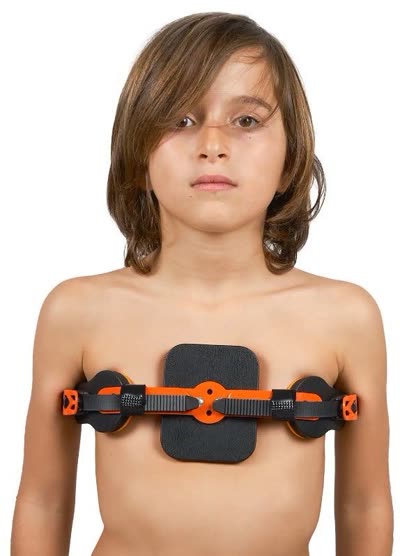 WP953 Pectus Carinatum Ortezi Dinamik (Güvercin Göğsü)