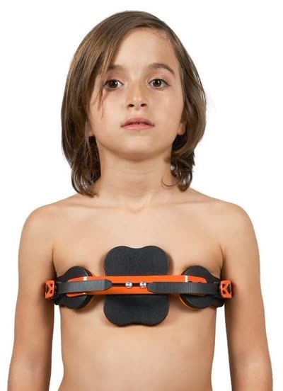 WP954 Pectus Carinatum Ortezi Asimetrik (Güvercin Göğsü)